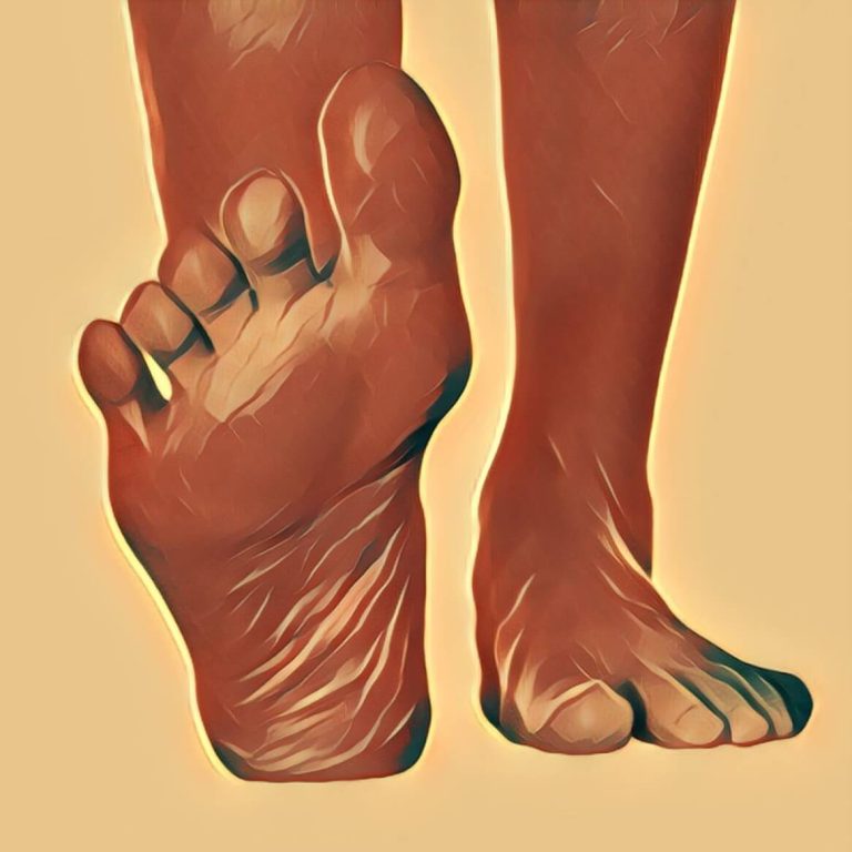 barefoot – dream interpretation